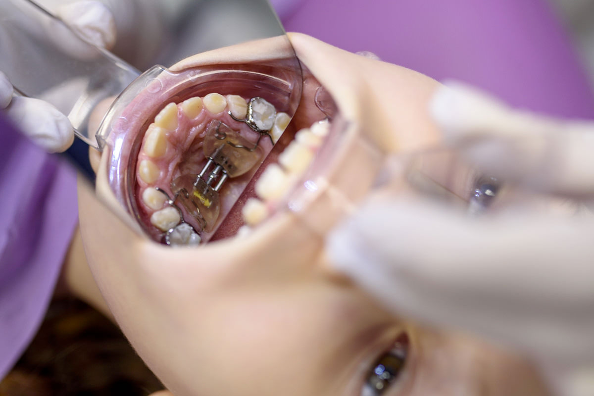 studio-dentistico-marchesini-ortodonzia